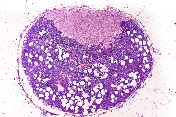 1200x800_cancer_de_mama